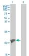 Twist-related protein 2 antibody, H00117581-M01, Novus Biologicals, Western Blot image 