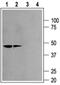 Potassium Voltage-Gated Channel Subfamily J Member 12 antibody, PA5-77602, Invitrogen Antibodies, Western Blot image 