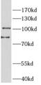 Protein Tyrosine Phosphatase Non-Receptor Type 3 antibody, FNab10135, FineTest, Western Blot image 