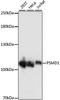 Proteasome 26S Subunit, Non-ATPase 1 antibody, A06293, Boster Biological Technology, Western Blot image 