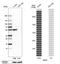 Glucose-6-Phosphate Dehydrogenase antibody, HPA000834, Atlas Antibodies, Western Blot image 