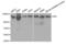 Hexokinase 1 antibody, abx000977, Abbexa, Western Blot image 