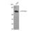 Cytochrome P450 Family 19 Subfamily A Member 1 antibody, STJ92555, St John
