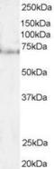 Pescadillo Ribosomal Biogenesis Factor 1 antibody, GTX47602, GeneTex, Western Blot image 