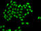 PHD Finger Protein 11 antibody, LS-C748480, Lifespan Biosciences, Immunofluorescence image 