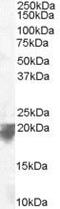 VPS29 Retromer Complex Component antibody, PA5-18244, Invitrogen Antibodies, Western Blot image 