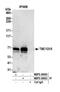 TBC1 Domain Family Member 15 antibody, NBP2-36552, Novus Biologicals, Western Blot image 