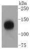 Transforming Acidic Coiled-Coil Containing Protein 3 antibody, A02876-1, Boster Biological Technology, Western Blot image 