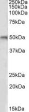 Adrenoceptor Beta 1 antibody, MBS420627, MyBioSource, Western Blot image 