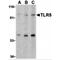 Toll Like Receptor 5 antibody, MBS151431, MyBioSource, Western Blot image 