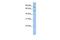 T-Complex-Associated-Testis-Expressed 1 antibody, GTX45531, GeneTex, Western Blot image 