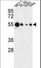 Interferon-inducible protein AIM2 antibody, LS-C156196, Lifespan Biosciences, Western Blot image 