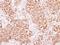 Adaptor Related Protein Complex 2 Subunit Beta 1 antibody, GTX112479, GeneTex, Immunohistochemistry paraffin image 