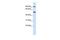 Lysyl Oxidase Like 1 antibody, GTX45381, GeneTex, Western Blot image 