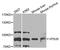 VPS35 Retromer Complex Component antibody, A7117, ABclonal Technology, Western Blot image 