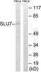 Pre-mRNA-splicing factor SLU7 antibody, TA315075, Origene, Western Blot image 