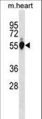 Glucose-6-Phosphate Isomerase antibody, LS-C157914, Lifespan Biosciences, Western Blot image 