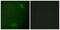 Interleukin 1 Receptor Associated Kinase 1 antibody, PA5-38284, Invitrogen Antibodies, Immunofluorescence image 