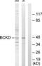 Branched Chain Keto Acid Dehydrogenase Kinase antibody, TA326221, Origene, Western Blot image 