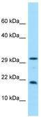 Crystallin Gamma N antibody, TA333508, Origene, Western Blot image 