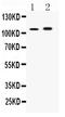 ADAM Metallopeptidase With Thrombospondin Type 1 Motif 1 antibody, A03009-1, Boster Biological Technology, Western Blot image 
