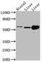 Aldehyde Dehydrogenase 2 Family Member antibody, CSB-RA799763A0HU, Cusabio, Western Blot image 