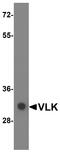 Anaphase Promoting Complex Subunit 13 antibody, A14554, Boster Biological Technology, Western Blot image 