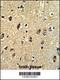 ATP Binding Cassette Subfamily C Member 5 antibody, 63-526, ProSci, Immunohistochemistry paraffin image 