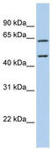 Adenosine Deaminase 2 antibody, TA342028, Origene, Western Blot image 