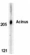 Apoptotic Chromatin Condensation Inducer 1 antibody, LS-B3189, Lifespan Biosciences, Western Blot image 