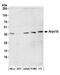 Actin Related Protein 2/3 Complex Subunit 1B antibody, NBP1-46219, Novus Biologicals, Western Blot image 