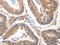 Cell Division Cycle 6 antibody, CSB-PA245457, Cusabio, Immunohistochemistry paraffin image 