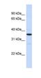 Regulator Of Microtubule Dynamics 3 antibody, orb330508, Biorbyt, Western Blot image 