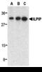 STE20 Related Adaptor Beta antibody, 3201, ProSci, Western Blot image 