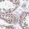 SIN3 Transcription Regulator Family Member A antibody, NBP2-38564, Novus Biologicals, Immunohistochemistry frozen image 