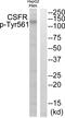 Colony Stimulating Factor 1 Receptor antibody, AP55719PU-N, Origene, Western Blot image 