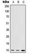 Ribosomal Protein S17 antibody, LS-C353872, Lifespan Biosciences, Western Blot image 