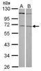 Zinc Finger Protein 503 antibody, GTX122143, GeneTex, Western Blot image 