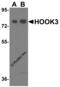 Hook Microtubule Tethering Protein 3 antibody, 8425, ProSci, Western Blot image 