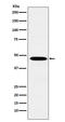 Wnt Family Member 2B antibody, M04879, Boster Biological Technology, Western Blot image 