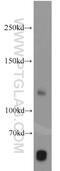 Pitrilysin Metallopeptidase 1 antibody, 10101-2-AP, Proteintech Group, Western Blot image 