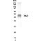 Colony Stimulating Factor 3 Receptor antibody, GTX19479, GeneTex, Western Blot image 