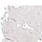 Acyl-CoA Thioesterase 4 antibody, PA5-51453, Invitrogen Antibodies, Immunohistochemistry paraffin image 