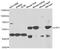 Leucine Aminopeptidase 3 antibody, A7101, ABclonal Technology, Western Blot image 