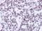 Lamin A/C antibody, LS-C186225, Lifespan Biosciences, Immunohistochemistry paraffin image 