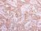 GDP-Mannose 4,6-Dehydratase antibody, NBP1-33424, Novus Biologicals, Immunohistochemistry paraffin image 