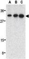 STE20 Related Adaptor Beta antibody, GTX31679, GeneTex, Western Blot image 