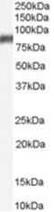 Arachidonate 5-Lipoxygenase antibody, MBS420520, MyBioSource, Western Blot image 