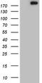 DNA Topoisomerase II Alpha antibody, LS-C797980, Lifespan Biosciences, Western Blot image 