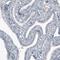 SRY-Box 21 antibody, NBP2-59059, Novus Biologicals, Immunohistochemistry paraffin image 